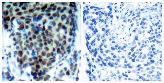 Anti-phospho-MAPK14 (pThr180) antibody produced in rabbit affinity isolated antibody