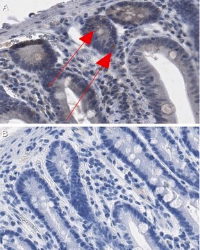 Anti-CCL4/MIP1&#946; Antibody, clone 4G11.10.5