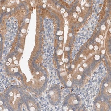 Anti-TRIT1 antibody produced in rabbit Prestige Antibodies&#174; Powered by Atlas Antibodies, affinity isolated antibody, buffered aqueous glycerol solution