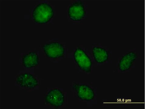 抗PFKFB3抗体 マウス宿主抗体 IgG fraction of antiserum, buffered aqueous solution