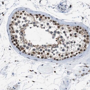 Anti-USP7 antibody produced in rabbit Prestige Antibodies&#174; Powered by Atlas Antibodies, affinity isolated antibody, buffered aqueous glycerol solution