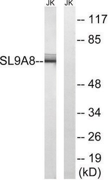 Anti-SLC9A8 antibody produced in rabbit affinity isolated antibody