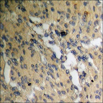 Anti-phospho-MDM2 (pSer186+Ser188) antibody produced in rabbit affinity isolated antibody