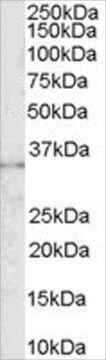 Anti-CD32/FCGR2B antibody produced in goat affinity isolated antibody, buffered aqueous solution