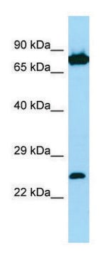 Anti-SNX27 (C-terminal) antibody produced in rabbit affinity isolated antibody