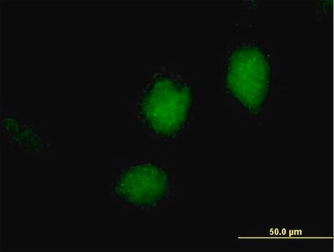 Anti-RARRES3 antibody produced in mouse purified immunoglobulin, buffered aqueous solution