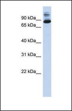 Anti-SIX4, (N-terminal) antibody produced in rabbit affinity isolated antibody