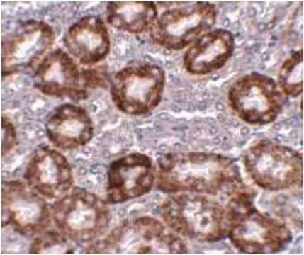 Anti-RTP801 Antibody from rabbit, purified by affinity chromatography