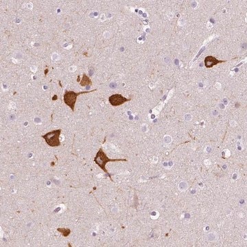 Anti-FAM163B antibody produced in rabbit Prestige Antibodies&#174; Powered by Atlas Antibodies, affinity isolated antibody