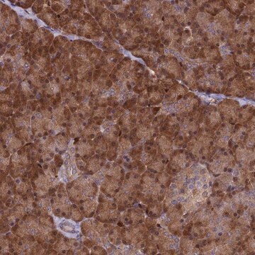 Anti-ARHGAP18 antibody produced in rabbit Prestige Antibodies&#174; Powered by Atlas Antibodies, affinity isolated antibody, buffered aqueous glycerol solution