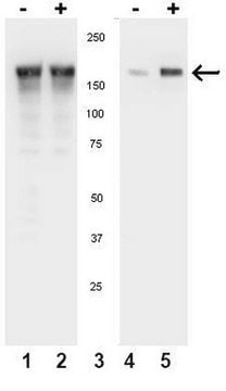 Anti-phospho-EGFR (Tyr1086) Antibody Upstate&#174;, from rabbit