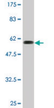 Monoclonal Anti-RBKS antibody produced in mouse clone 3B4, purified immunoglobulin, buffered aqueous solution