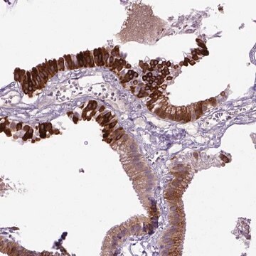 Anti-DEPDC1B antibody produced in rabbit Prestige Antibodies&#174; Powered by Atlas Antibodies, affinity isolated antibody