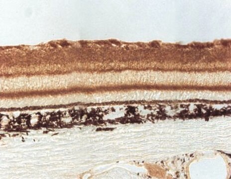 Anti-Sodium Channel NaB2 Antibody Chemicon&#174;, from rabbit