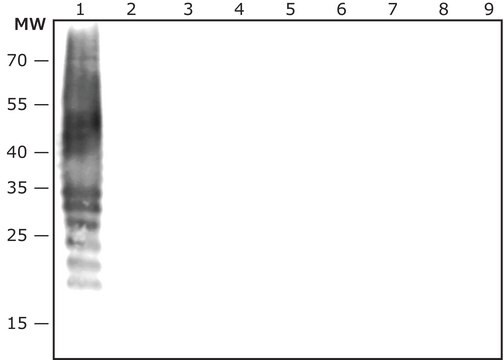 抗牙龈卟啉单胞菌抗体，兔，生产 IgG fraction of antiserum