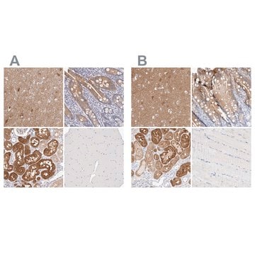 Anti-GDA antibody produced in rabbit Prestige Antibodies&#174; Powered by Atlas Antibodies, affinity isolated antibody, buffered aqueous glycerol solution