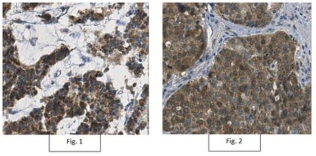 Anti-Thymidylate Kinase/TMPK Antibody, clone 1A5.1 clone 1A5.1, from mouse