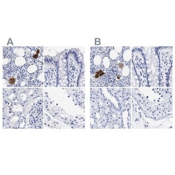 Anti-TREML1 antibody produced in rabbit Prestige Antibodies&#174; Powered by Atlas Antibodies, affinity isolated antibody, buffered aqueous glycerol solution