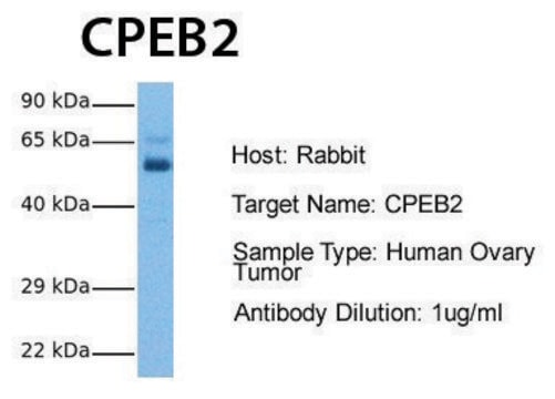 Anti-CPEB2 (AB1) antibody produced in rabbit affinity isolated antibody