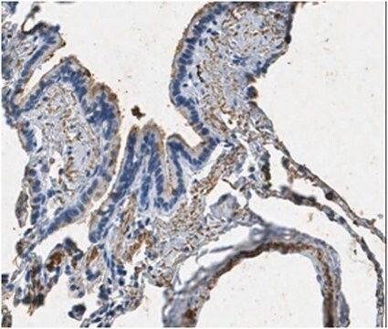 Anti-Surfactant-Protein&nbsp;A-Antikörper from rabbit