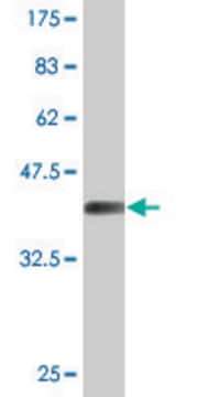 Monoclonal Anti-LAD1, (C-terminal) antibody produced in mouse clone 2A9, purified immunoglobulin, buffered aqueous solution