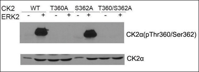 Anti-CK2&#945; antibody produced in rabbit affinity isolated antibody