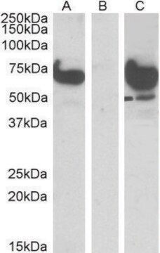 Anti-EPM2AIP1 (N-terminal) antibody produced in goat affinity isolated antibody, buffered aqueous solution