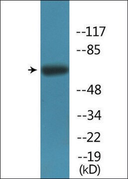 Anti-phospho-Fyn (pTyr530) antibody produced in rabbit affinity isolated antibody