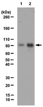 Anti-acetyl Cortactin Antibody from rabbit, purified by affinity chromatography