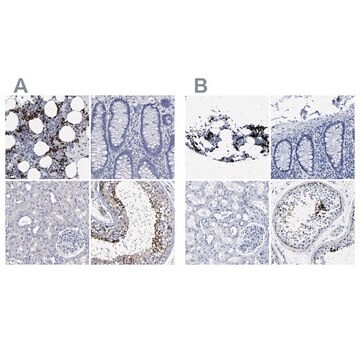 Anti-HEMGN antibody produced in rabbit Prestige Antibodies&#174; Powered by Atlas Antibodies, affinity isolated antibody, buffered aqueous glycerol solution, Ab1