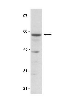 Anti-AMPK &#945;-pan Antibody Upstate&#174;, from rabbit