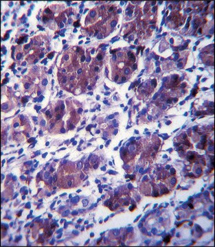 ANTI-CCDC22 (C-TERM) antibody produced in rabbit IgG fraction of antiserum, buffered aqueous solution