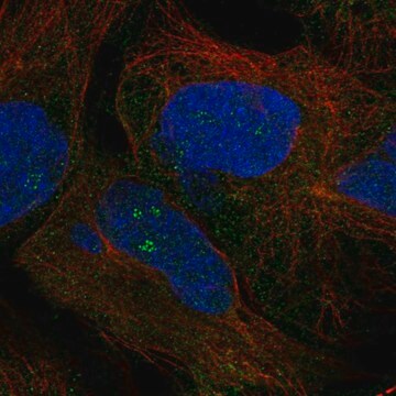 Anti-Znf728 Antibody Produced In Rabbit Prestige Antibodies&#174; Powered by Atlas Antibodies, affinity isolated antibody, buffered aqueous glycerol solution