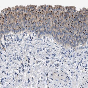 Anti-ADGRE3 antibody produced in rabbit Prestige Antibodies&#174; Powered by Atlas Antibodies, affinity isolated antibody, buffered aqueous glycerol solution