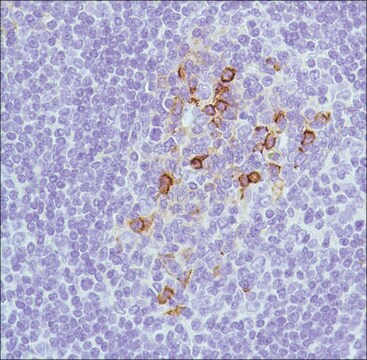 Anti-CD138 antibody, Rabbit monoclonal clone SP152, recombinant, expressed in proprietary host, affinity isolated antibody