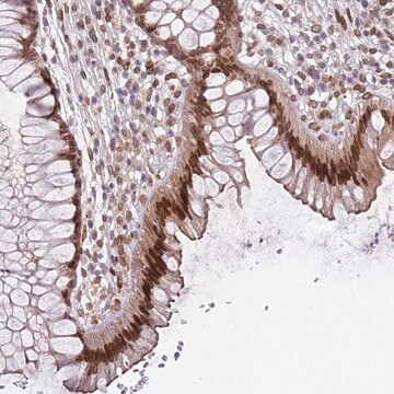 Anti-C1ORF145 antibody produced in rabbit Prestige Antibodies&#174; Powered by Atlas Antibodies, affinity isolated antibody, buffered aqueous glycerol solution