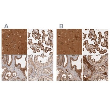 Anti-CAMSAP2 antibody produced in rabbit Prestige Antibodies&#174; Powered by Atlas Antibodies, affinity isolated antibody, buffered aqueous glycerol solution, Ab1