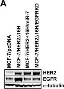 Anticuerpo anti-&#945;-tubulina, clon DM1A clone DM1A, Upstate&#174;, from mouse