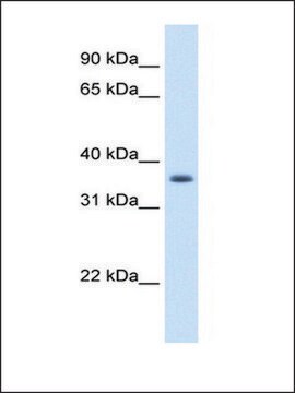 抗AKR1B10抗体 ウサギ宿主抗体 IgG fraction of antiserum