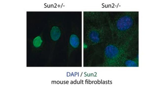 Anti-SUN2 Antibody, clone 3.1E clone 3.1E, from mouse