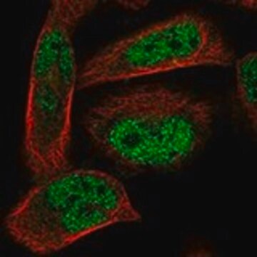 Anti-ADAL antibody produced in rabbit Prestige Antibodies&#174; Powered by Atlas Antibodies, affinity isolated antibody, buffered aqueous glycerol solution