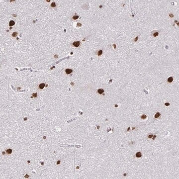 Anti-ZNF579 antibody produced in rabbit Prestige Antibodies&#174; Powered by Atlas Antibodies, affinity isolated antibody, buffered aqueous glycerol solution