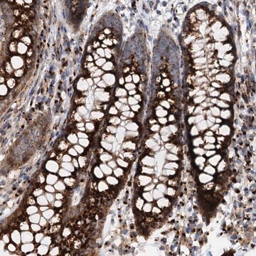 Anti-SUPT20H antibody produced in rabbit Prestige Antibodies&#174; Powered by Atlas Antibodies, affinity isolated antibody, buffered aqueous glycerol solution