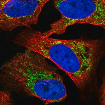 Anti-SLC16A12 antibody produced in rabbit Prestige Antibodies&#174; Powered by Atlas Antibodies, affinity isolated antibody, buffered aqueous glycerol solution