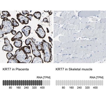 Anti-KRT7 antibody produced in rabbit Prestige Antibodies&#174; Powered by Atlas Antibodies, affinity isolated antibody, buffered aqueous glycerol solution