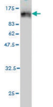 ANTI-TOP3B antibody produced in mouse clone 1H8, purified immunoglobulin, buffered aqueous solution