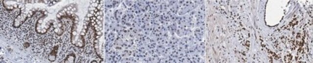 Anti-RAD9A Antibody, clone 5H8.1 clone 5H8.1, from mouse