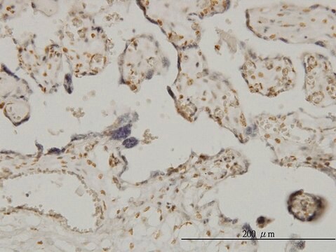 Monoclonal Anti-ETV6 antibody produced in mouse clone 3B10, purified immunoglobulin, buffered aqueous solution