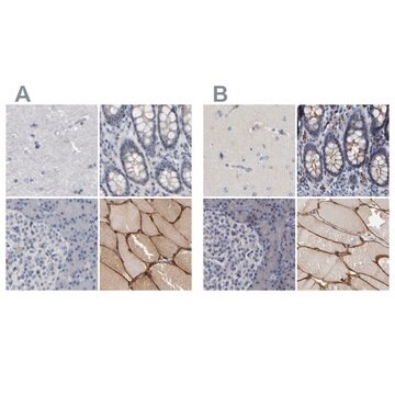 Anti-MURC antibody produced in rabbit Prestige Antibodies&#174; Powered by Atlas Antibodies, affinity isolated antibody, buffered aqueous glycerol solution, Ab1