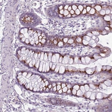 Anti-DBF4B antibody produced in rabbit Prestige Antibodies&#174; Powered by Atlas Antibodies, affinity isolated antibody, buffered aqueous glycerol solution